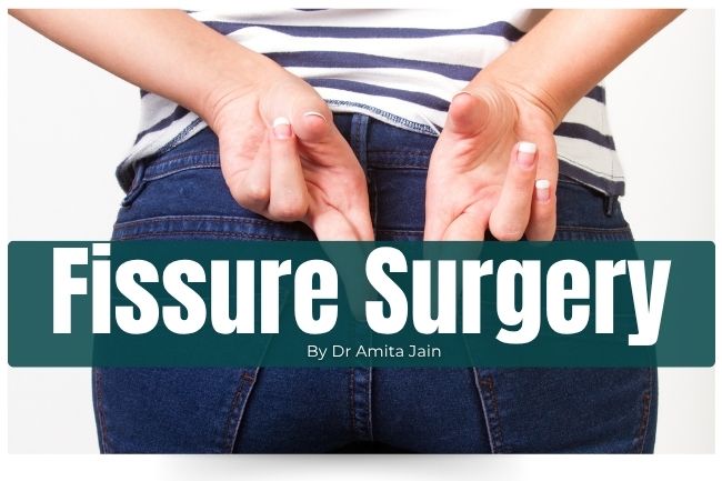 Dr Amita Jain is the best Lipoma Treatment and Surgeon in Delhi